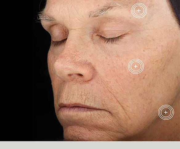 TNS Advanced+ Serum