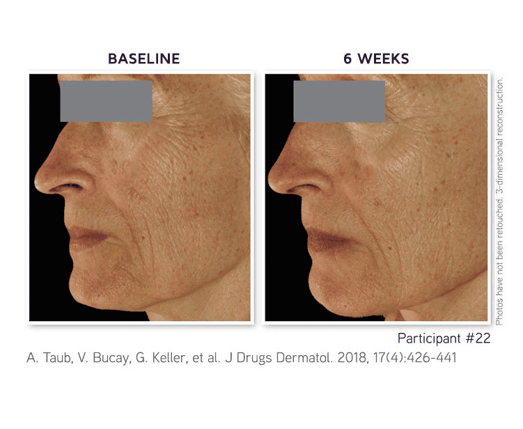 8-in-1 BioSerum PRO Exclusive Platinum Edition