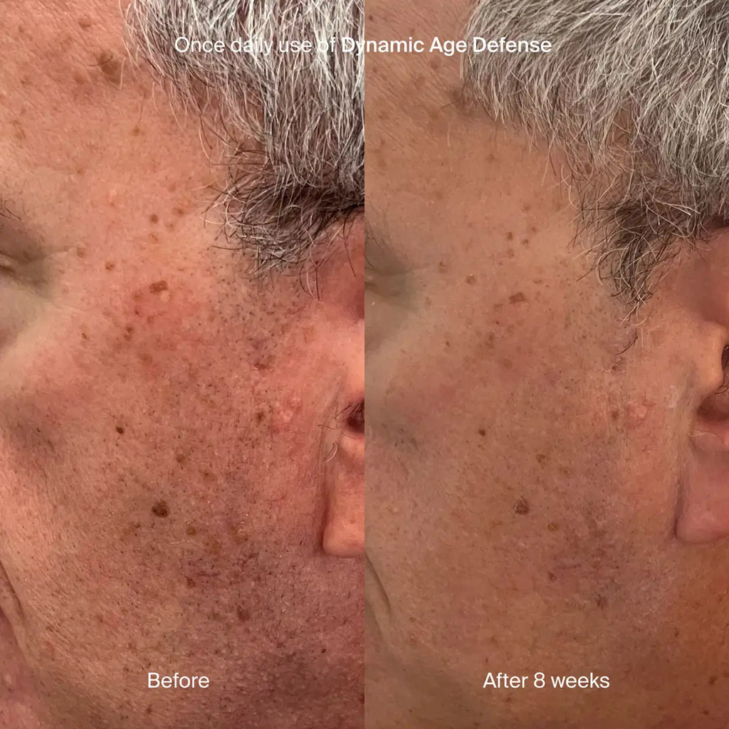 Dynamic Age Defense