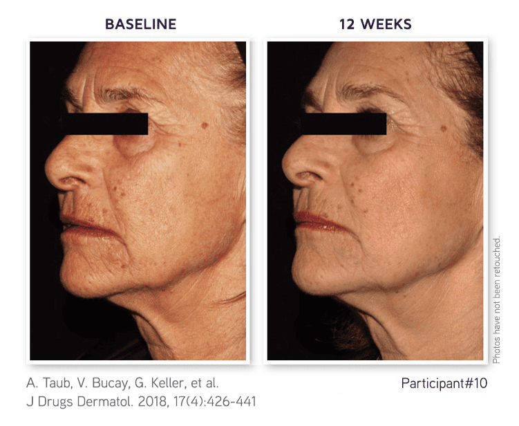 8-in-1 BioSerum PRO Exclusive Platinum Edition
