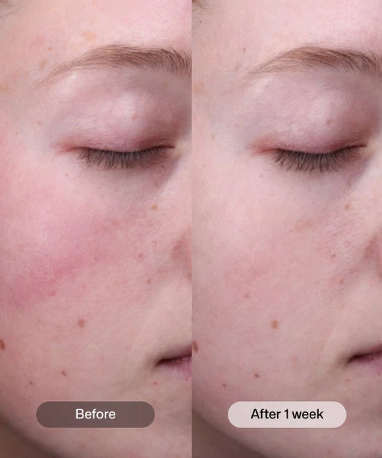 Radiance+ Resurfacing Serum