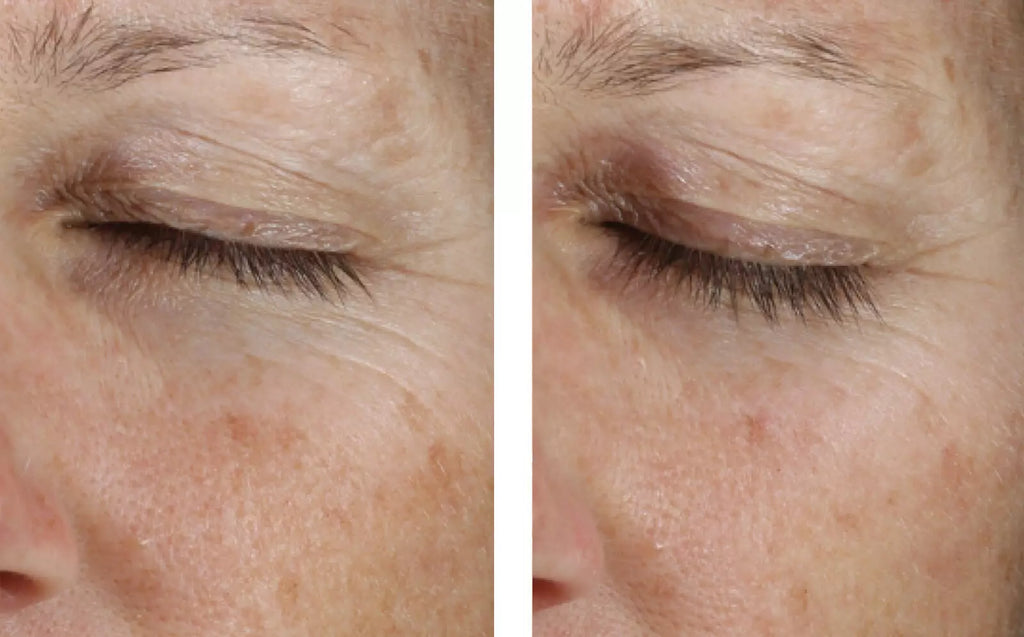 Instant Effect Gel EYE