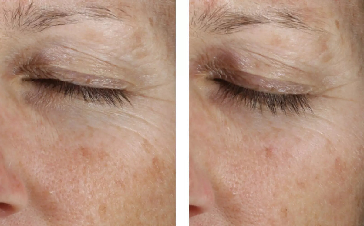 Instant Effect Gel EYE