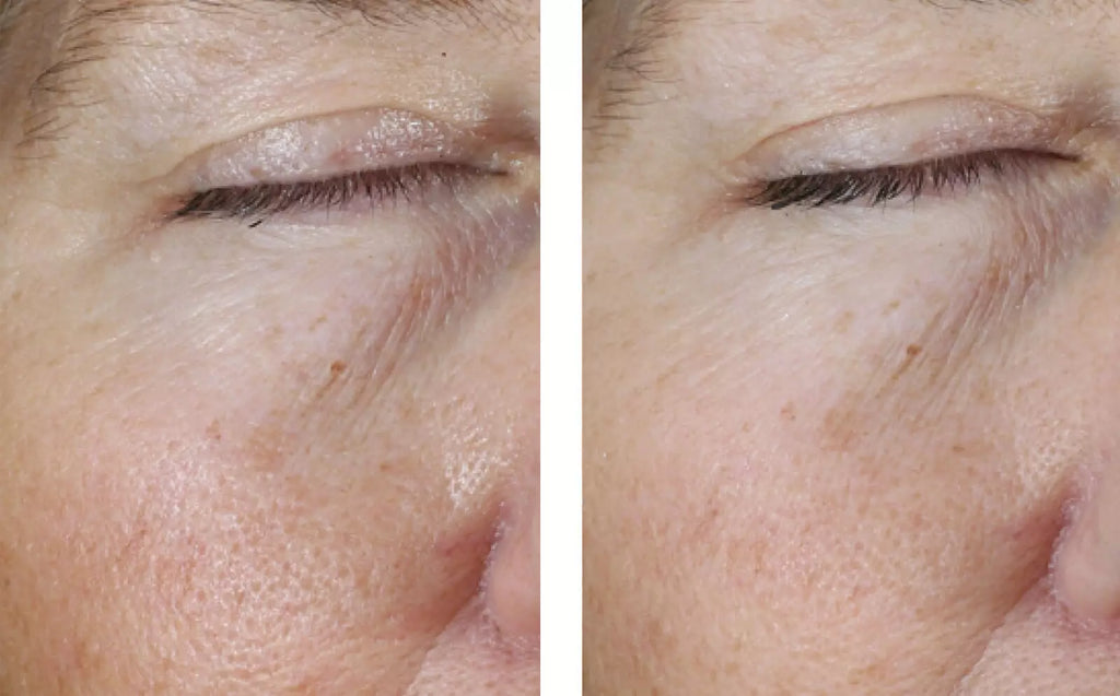 Instant Effect Gel EYE