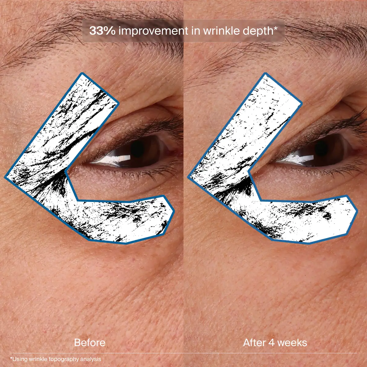Bioadaptive Stress Repair