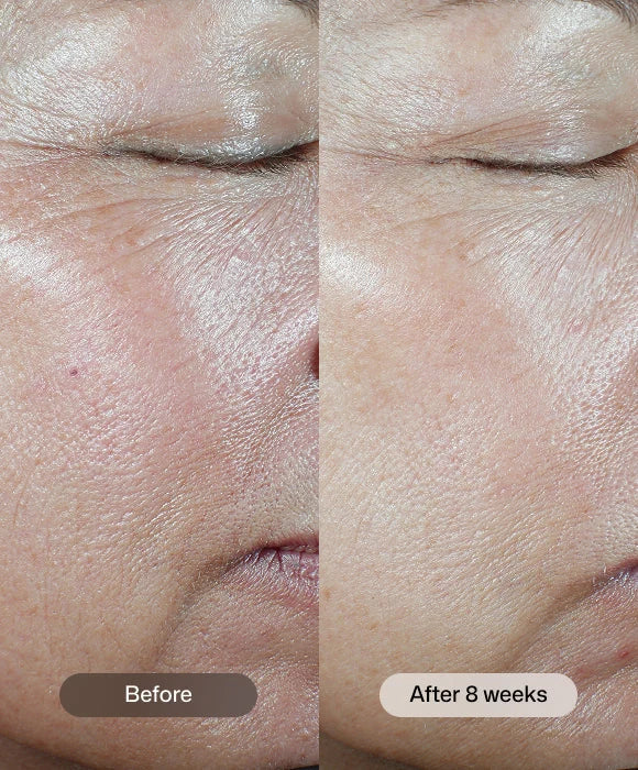 C+ Correcting Complex 30%®